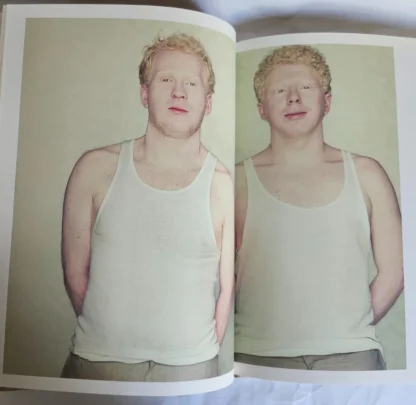 Albinos - Image 3