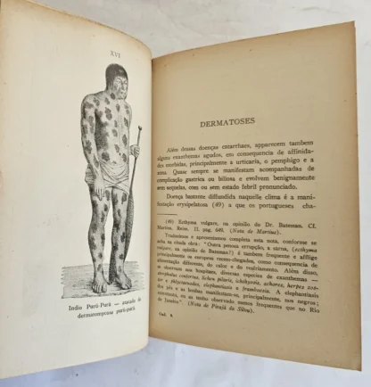 Natureza, Doenças, Medicina E Remédios Dos Índios Brasileiros - Image 3